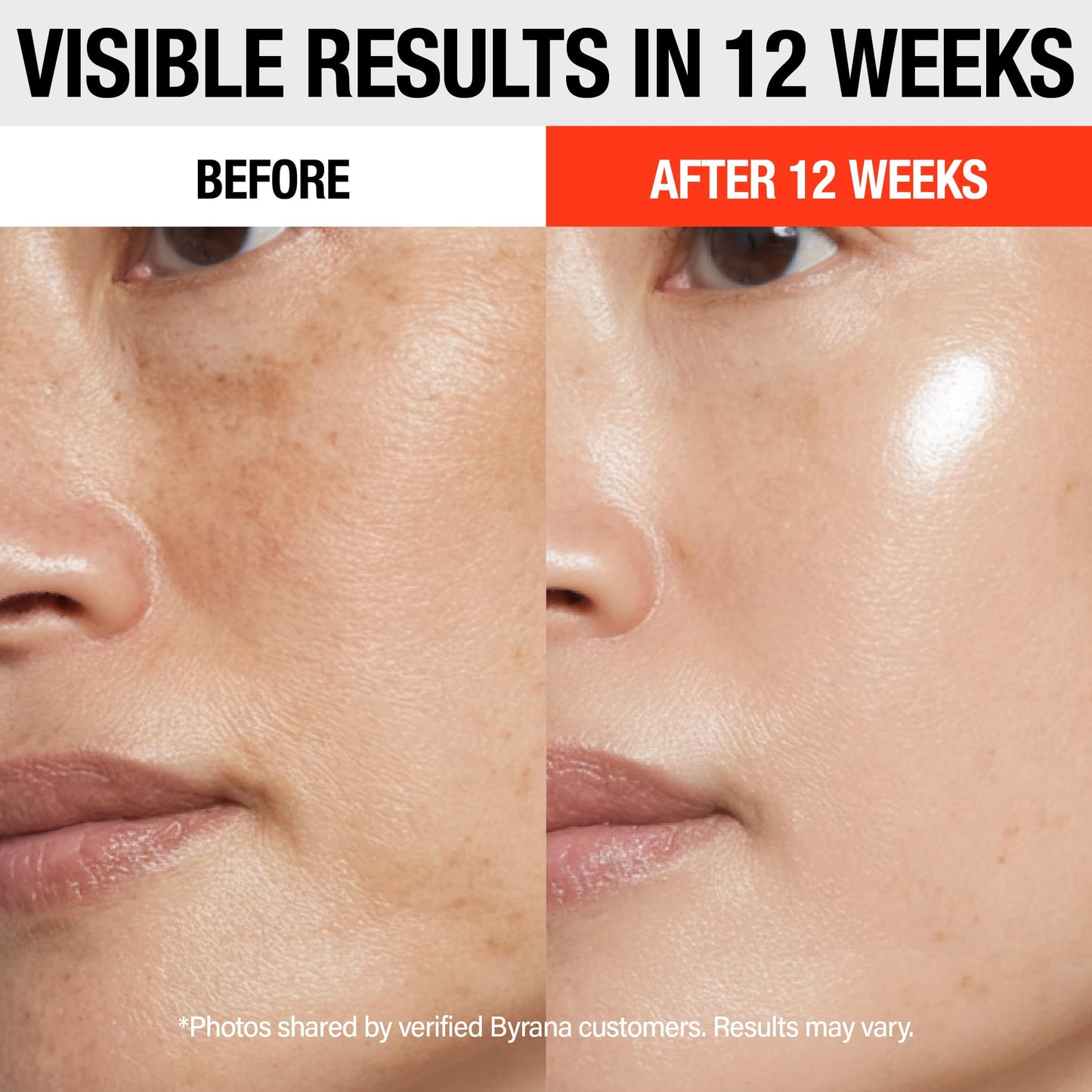 BYRANA Vitamin C Brilliant Glow Face Serum – Korean Anti Aging Skincare with THD Ascorbate, Matrixyl 3000, Ferulic Acid & Ginseng – Visibly Reduces Dark Spots, Uneven Tone, Fine Lines & Wrinkles