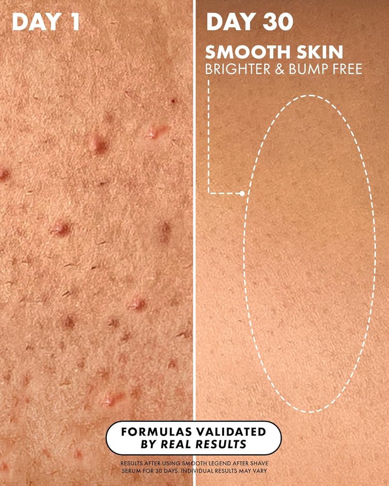 Luxury After Shave Serum - Soothing Hydration for Smooth, Irritation-Free Skin | Prevent Ingrown Hair