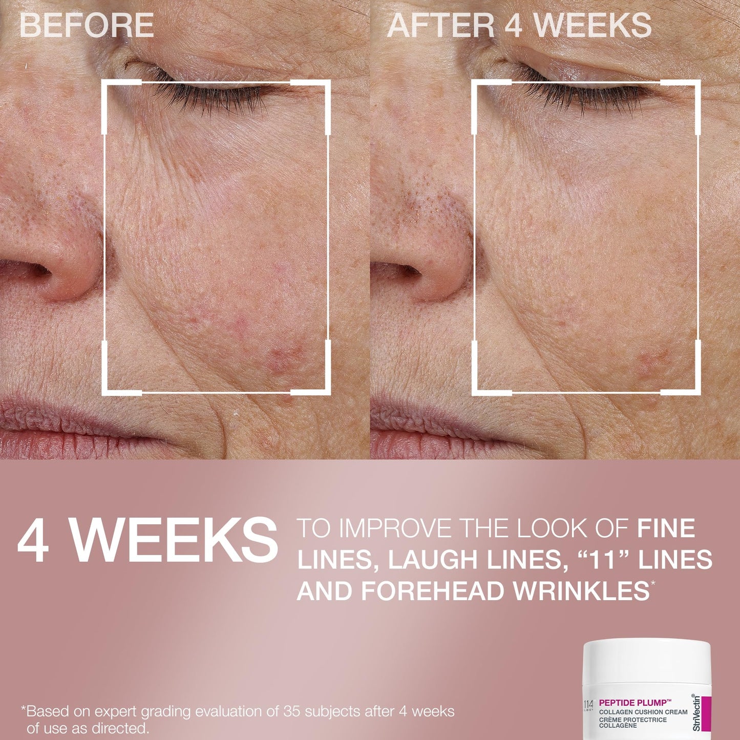 StriVectin Clinically Proven Skin Care Travel-Ready Minis 4-Piece Set