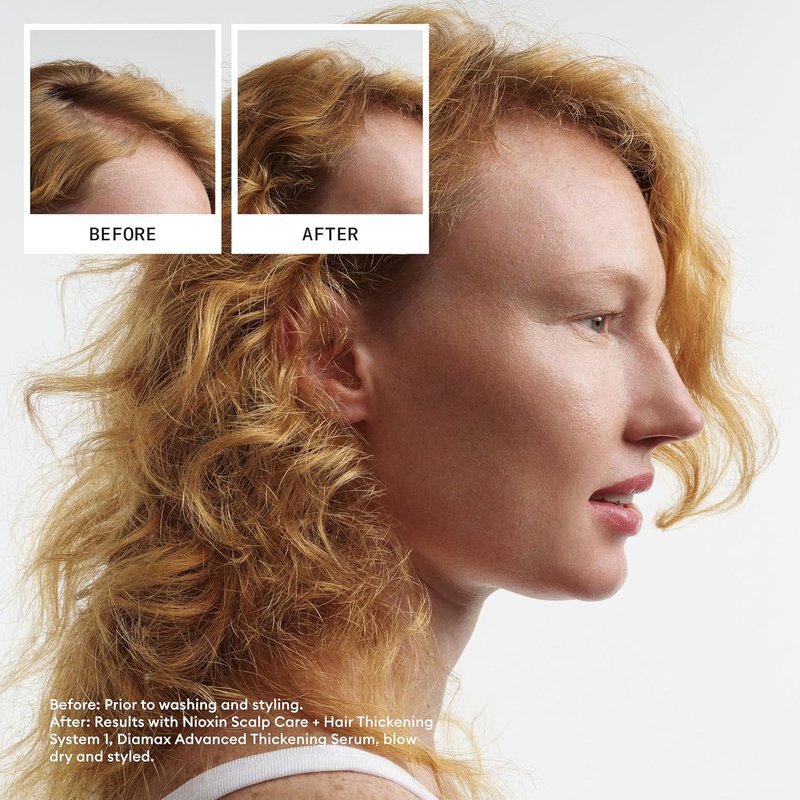 Nioxin Scalp & Hair Thickening Shampoo - Strengthen Natural Hair with Niacinamide & Biotin | Light Thinning Solution