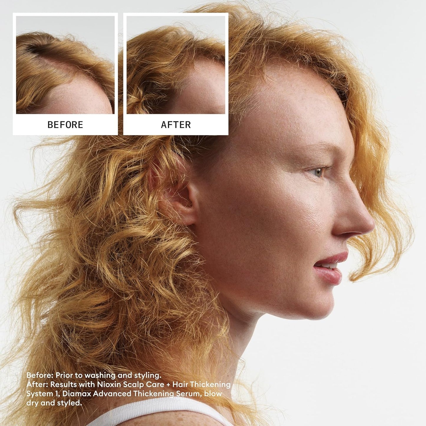 Nioxin Scalp & Hair Thickening Shampoo - Natural Hair Care | Strengthens Against Breakage with Niacinamide & Biotin