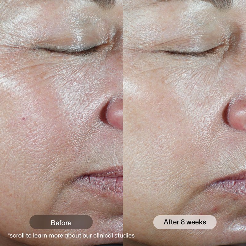 Revision Skincare C+ Correcting Complex 30%®, Anti Aging Antioxidant Blend with Vitamin C, Supports Healthy Skin, 1 fl oz