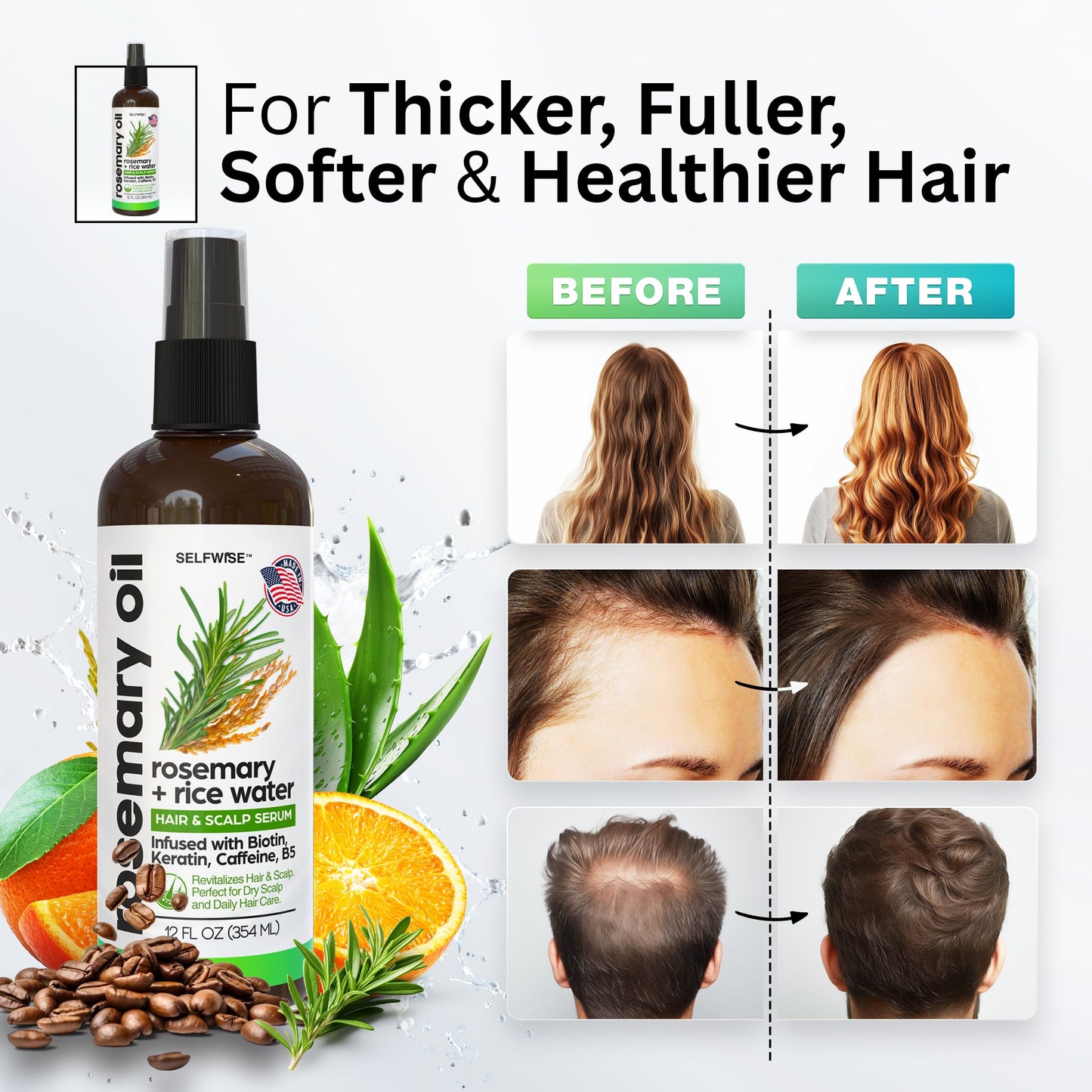 Rosemary Oil and Rice Water Hair Growth Spray - Serum with Biotin, Keratin, Caffeine, Vitamins C & B5 for Hair Mask, Hair Care, Scalp Treatment, Thickening Dry Damaged Hair for Women & Men 12oz