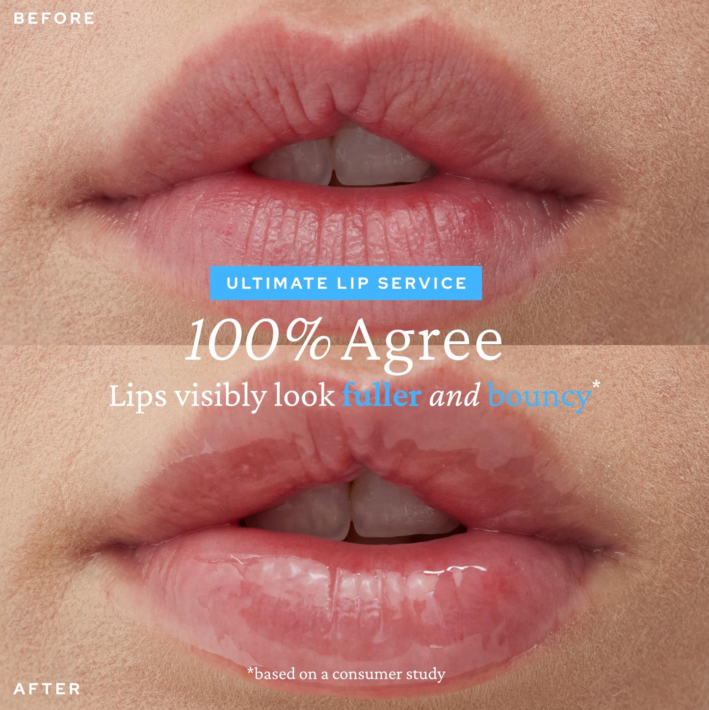 belif Super Knights Lipcerin - Plumping Lip Butter Balm with Hyaluronic Acid & Vitamin C | Hydrating Korean Lip Care for Teens & Women | Glossy Lip Balm | Small Gift