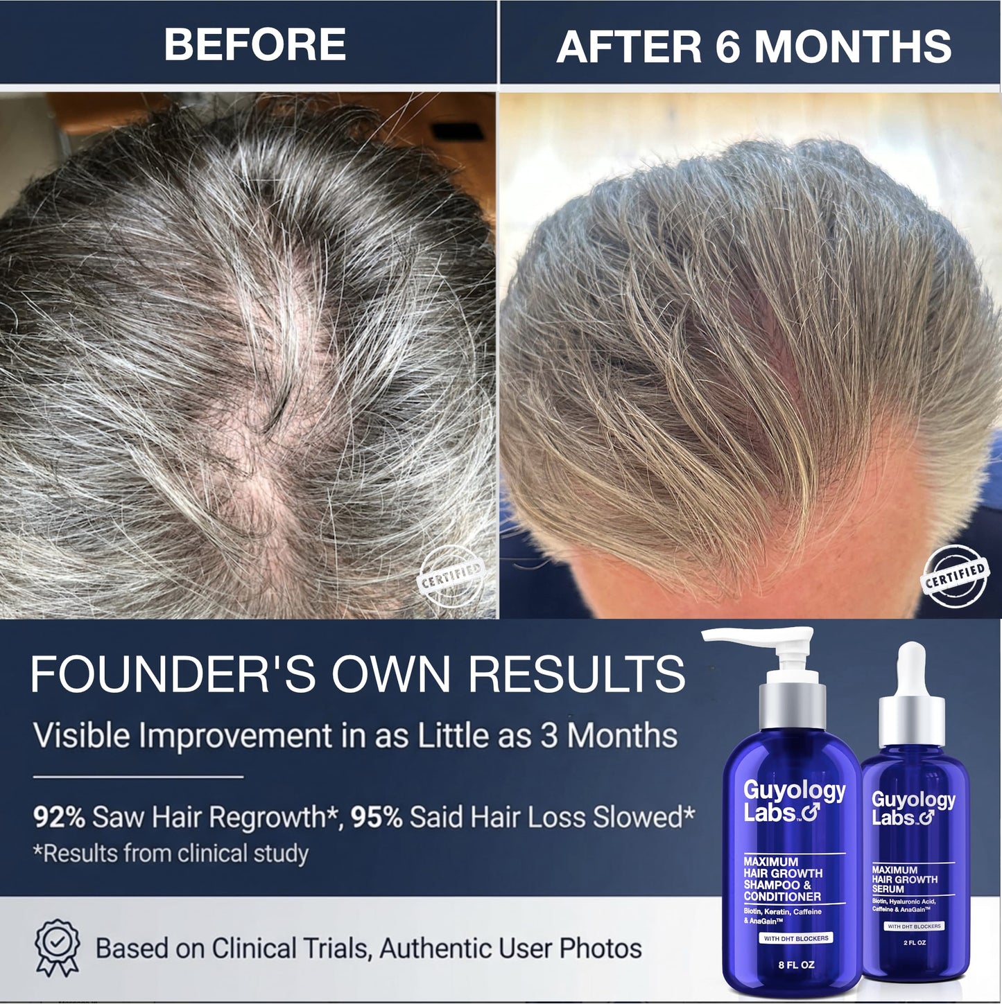 Hair Growth Serum for Men & Women | DHT Blocker for Hair Loss & Regrowth | Thickening Thinning Hair | 4% AnaGain™, Biotin & Caffeine | Dermatologist Recommended | Minoxidil Compatible | Guyology Labs