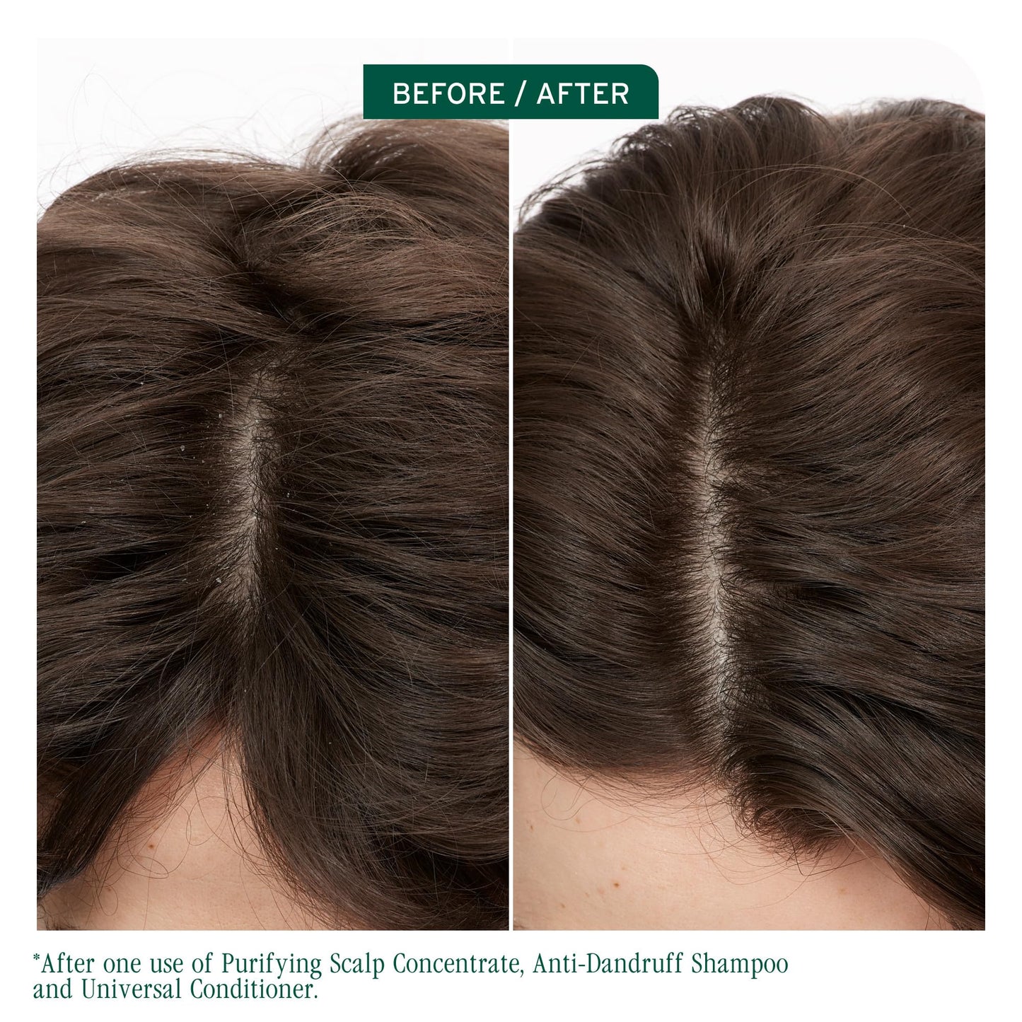 Biolage Scalp Sync Purifying Concentrate - For All Scalp Types, Exfoliating & Clarifying Treatment, Removes Buildup, Refreshing & Reinvigorating, Fermented Tea Blend & Glycolic Acid