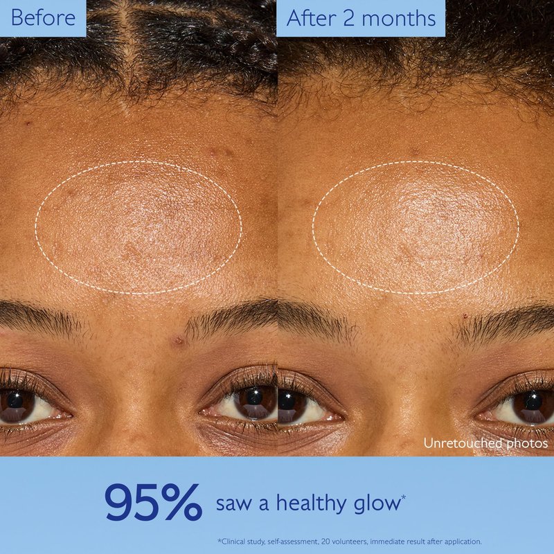 Caudalie Vinoperfect Instant Brightening Dark Spot Moisturizer with Niacinamide, Refill Pod - 50 mL