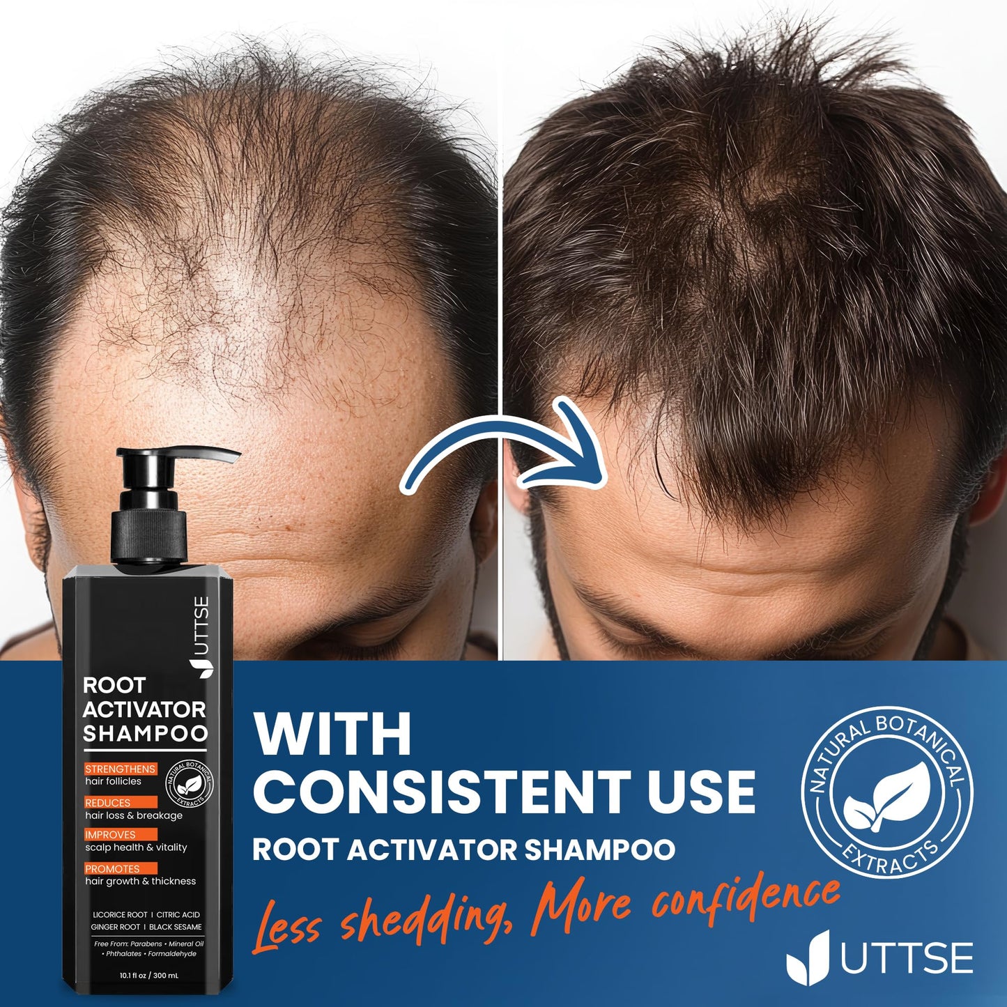 Root Activator Shampoo for Men: Hair Thickening Shampoo for Hair Loss and Thinning Hair