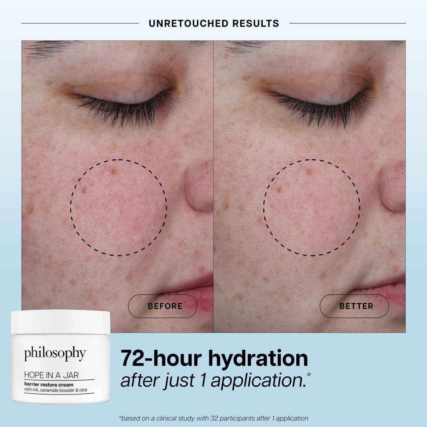 philosophy hope in a jar barrier restore cream – with ha+ complex, cica & ceramides – intensely hydrating moisturizer for dry, sensitive skin – repairs & soothes