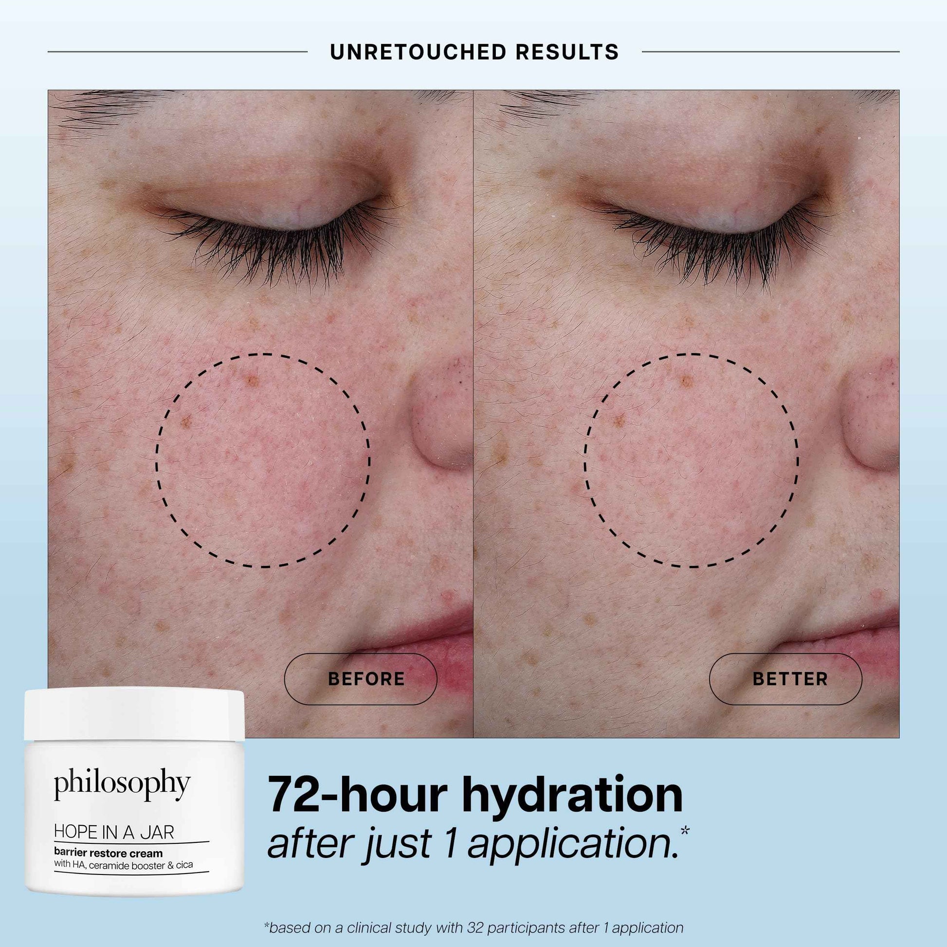 philosophy hope in a jar barrier restore cream – with ha+ complex, cica & ceramides – intensely hydrating moisturizer for dry, sensitive skin – repairs & soothes