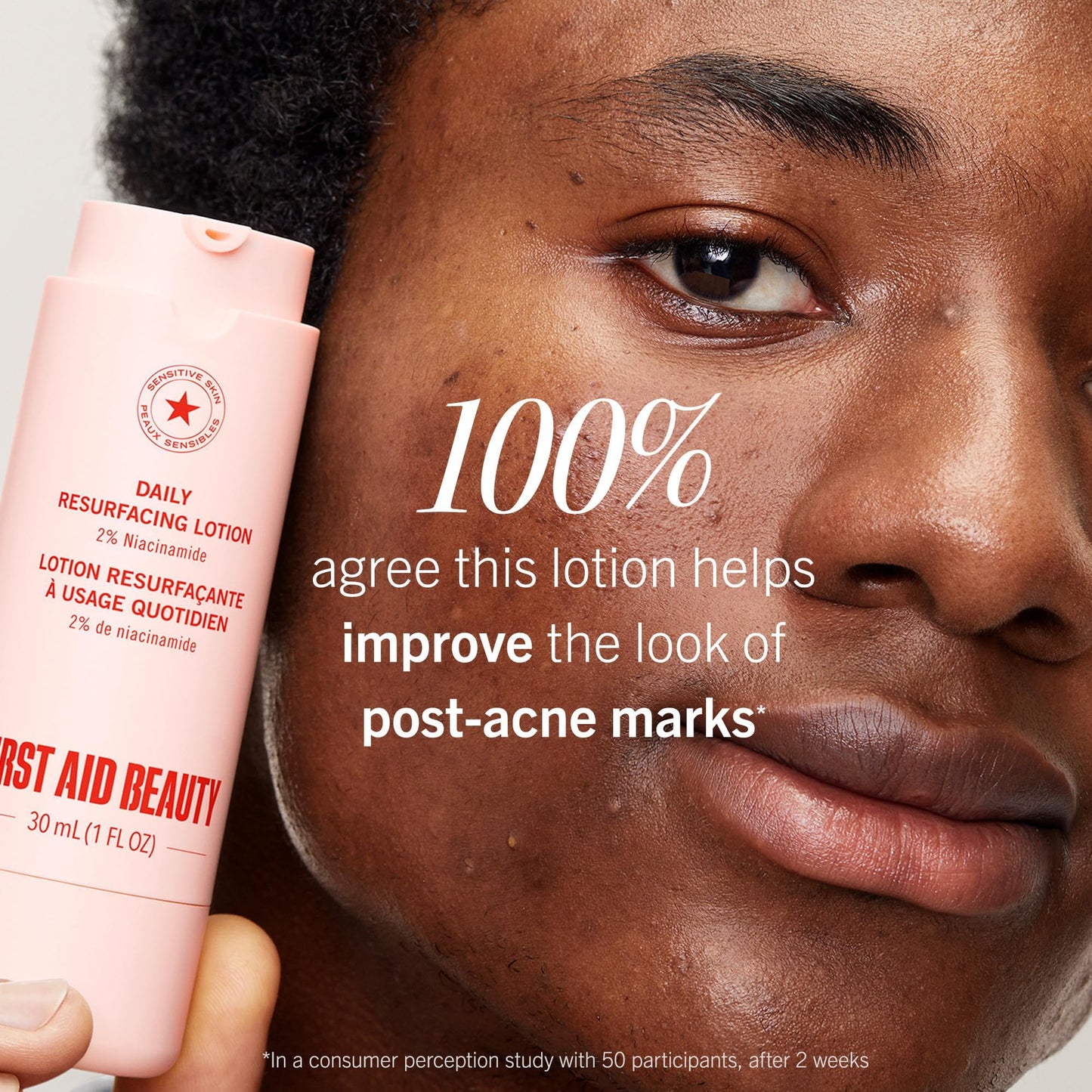 First Aid Beauty Lactic Acid Lotion for Acne-Prone Skin, 2% Niacinamide Resurfacing Moisturizer, Visibly Diminishes Post-Acne Marks, Safe for Sensitive Skin, 1 oz