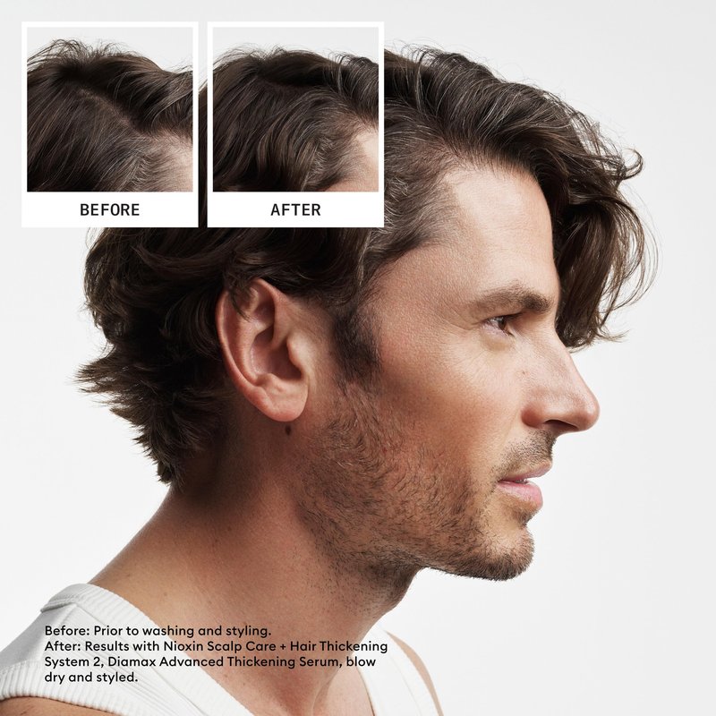 Nioxin Scalp + Hair Thickening System 2 | For Natural Hair with Progressed Thinning | Boost Hair Density with Niacinamide & Biotin | Trial Size | 1 Month Supply