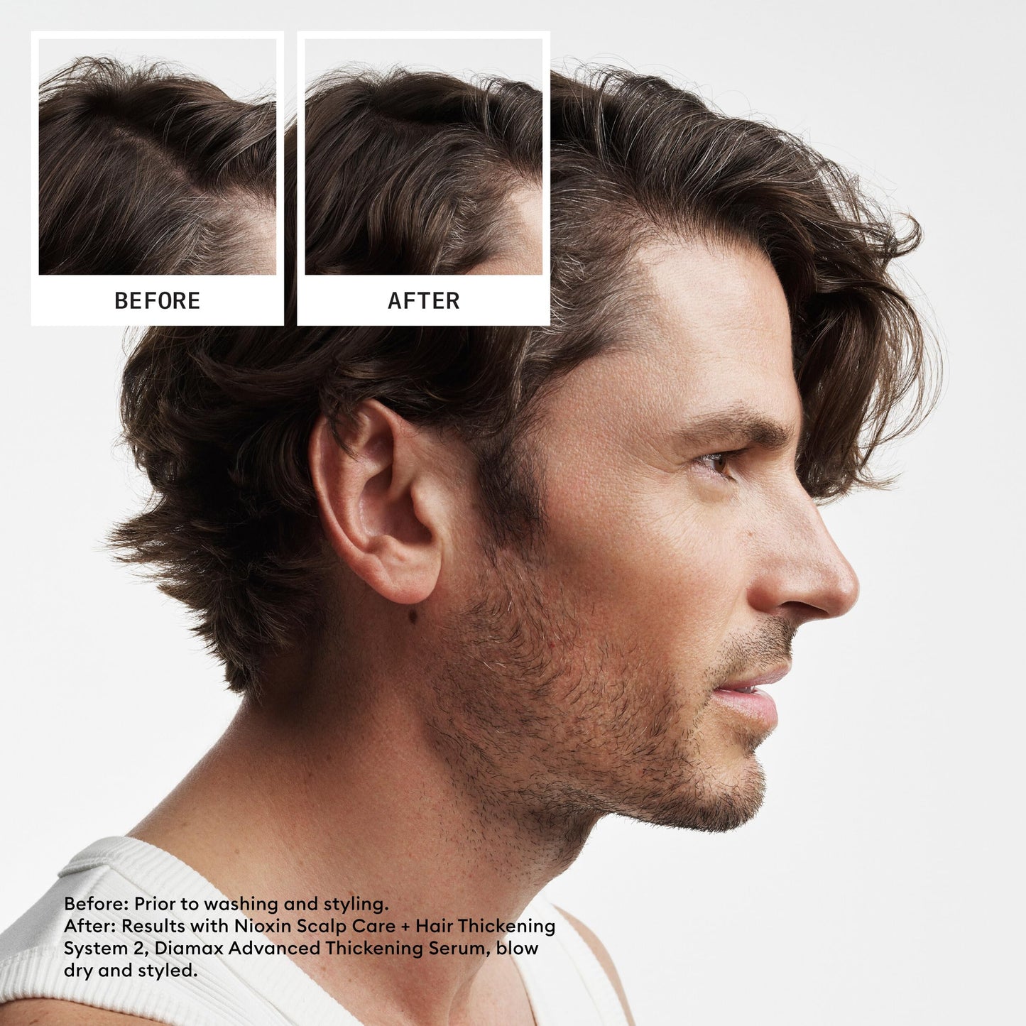 Nioxin System 2 Scalp Care + Hair Thickening Leave-In Treatment | For Natural Hair with Progressed Thinning | Boost Hair Density Against Breakage with Niacinamide & Biotin | 6.7 Fl Oz