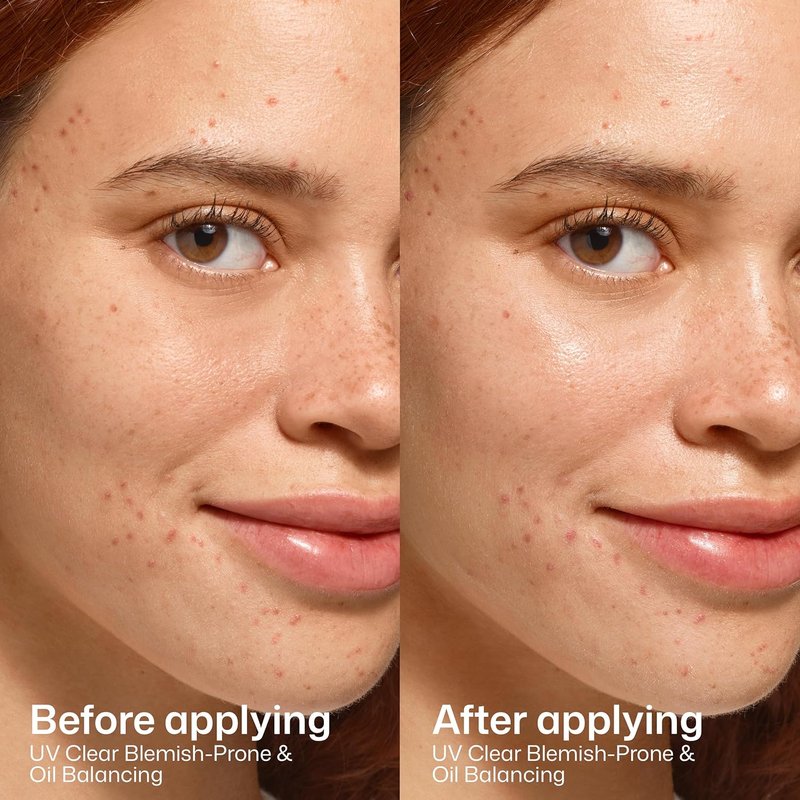 EltaMD UV Clear Sunscreen SPF 50 - Non-Comedogenic, Oil Balancing Formula for Blemish-Prone Skin