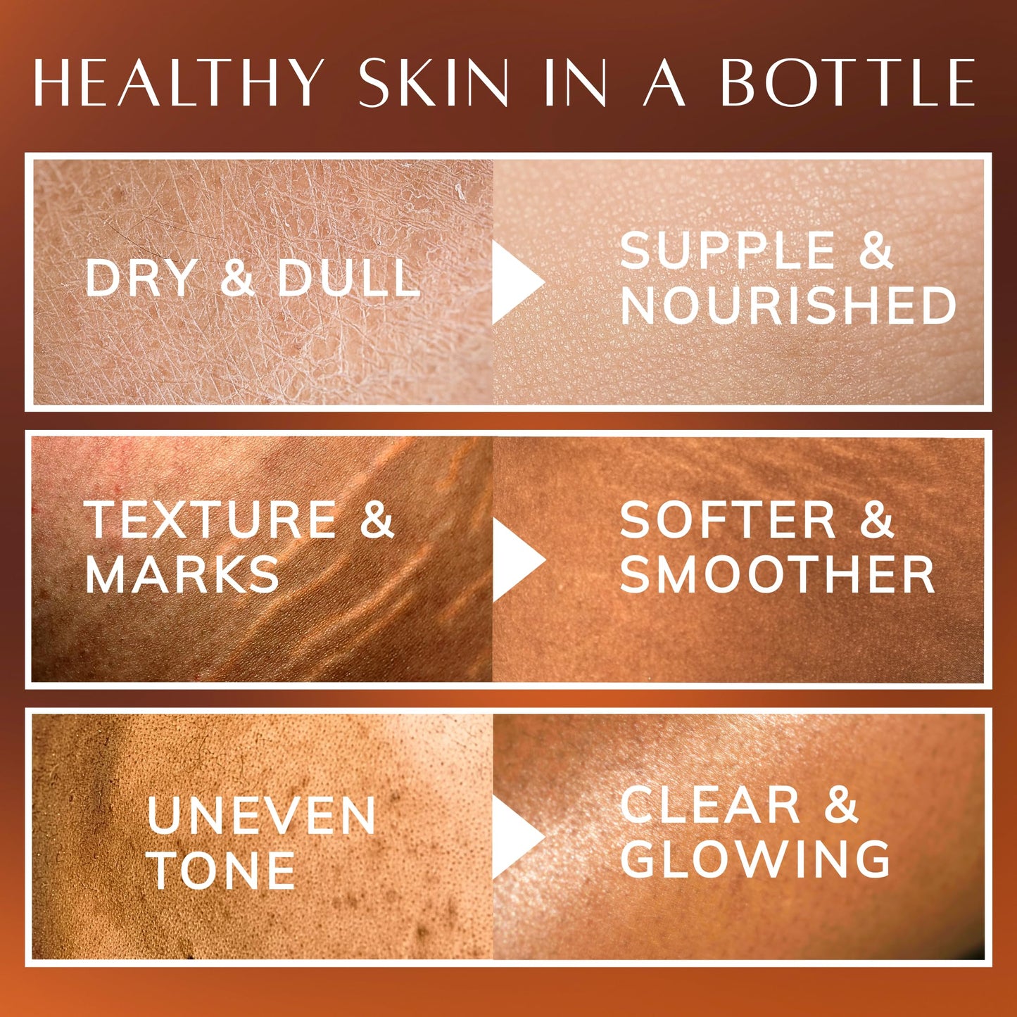 Bio+ Skin Moisturizer Body Oil for Women - Coconut, Jojoba, Olive & Almond Oils for Scars & Stretch Marks, Vanilla Scent & Vitamin E, Bio Oil Skincare, Stretch Mark Treatment