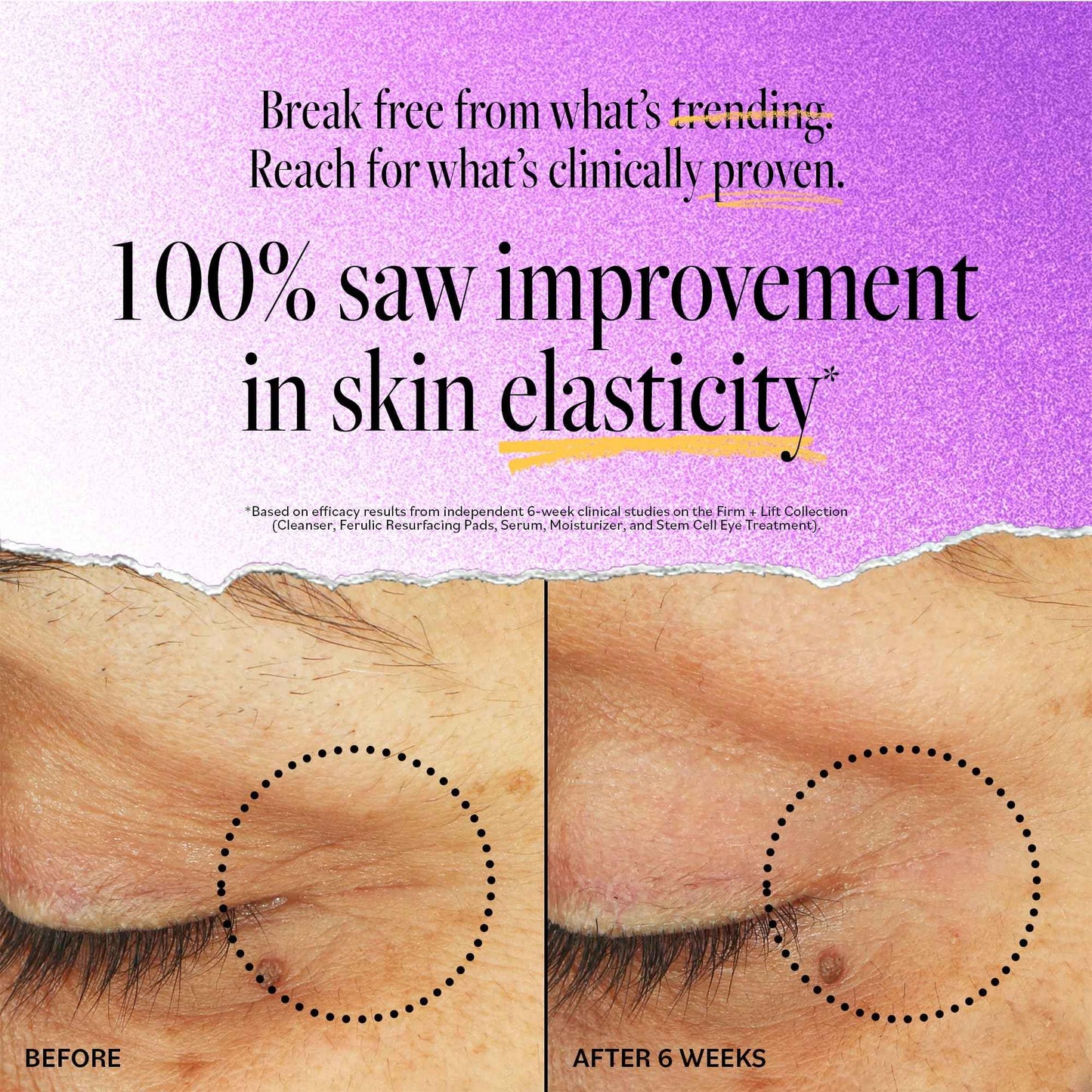 Derma E Stem Cell Lifting Eye Treatment – Multi Action Firming and Tightening Under Eye and Upper Eyelid Cream - Hydrating and Revitalizing Moisturizer, 0.5oz