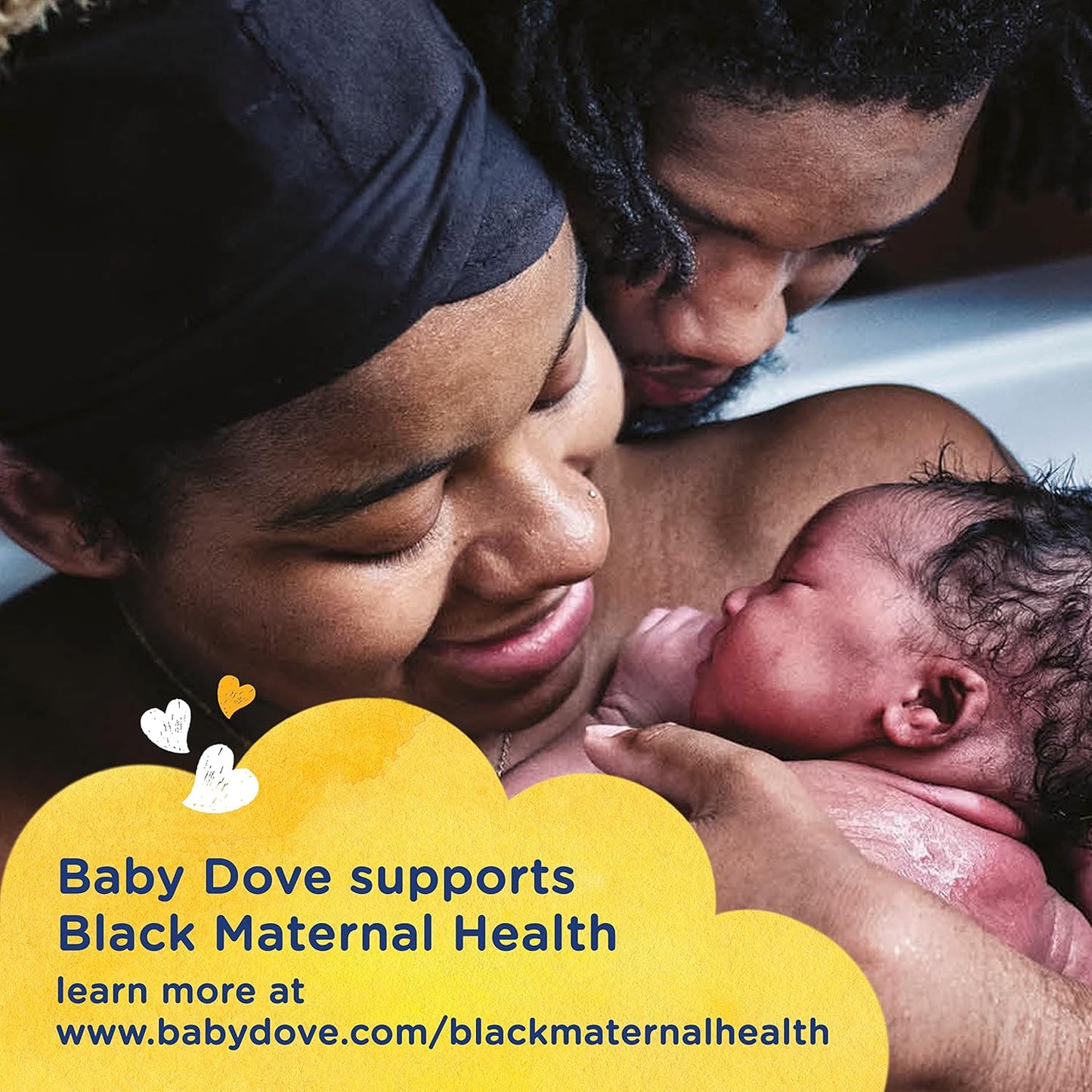 Baby Dove Sensitive Baby Wash - Tear-Free, Hypoallergenic Formula for Melanin-Rich Skin | 34 oz