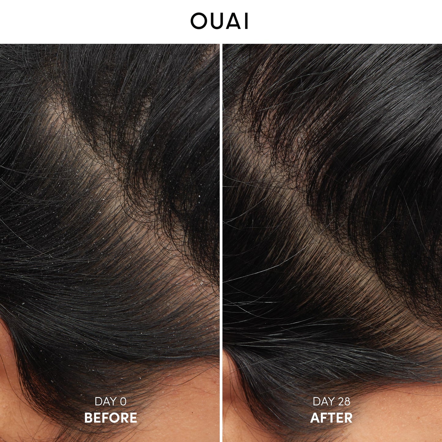 OUAI Detox Shampoo (10 fl oz) & Anti-Dandruff Deluxe Size (1 fl oz) Bundle - Soothing, Clarifying Shampoo Set for Dry, Flaky Scalp - Removes Dirt & Build Up (2 Count)
