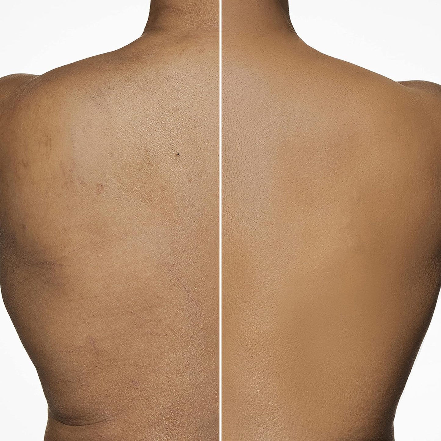 Dermablend Leg and Body Makeup Foundation - SPF 25 for All-Day Coverage
