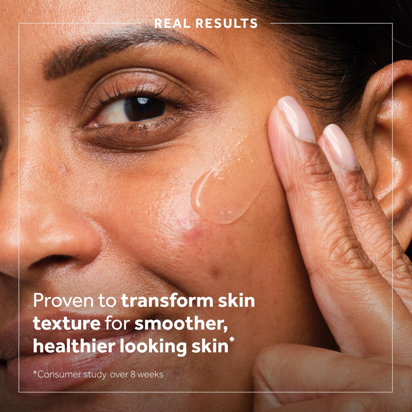 No7 Derm Solutions AHA Exfoliant & Face Toner with Lactic & Glycolic Acid - AHA Smoothing Treatment - Controls Oil and Minimizes Pores - for Oily & Blemish-Prone Skin (1 Fl Oz)
