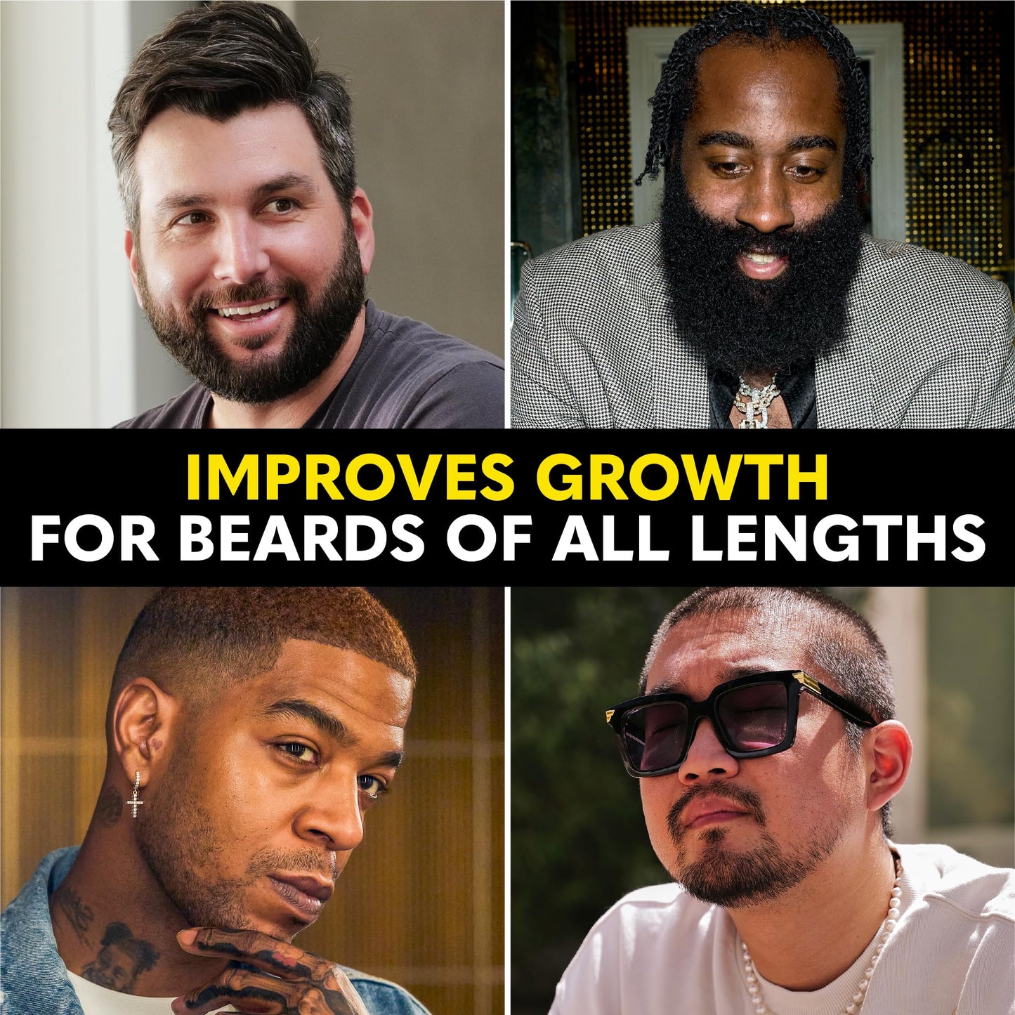 The Beard Club - Beard Growth Vitamins - Support A Thicker Fuller Beard, Fill in Patches - Minerals & Multi-Vitamins Help Support and Stimulate Healthier Facial Hair Growth