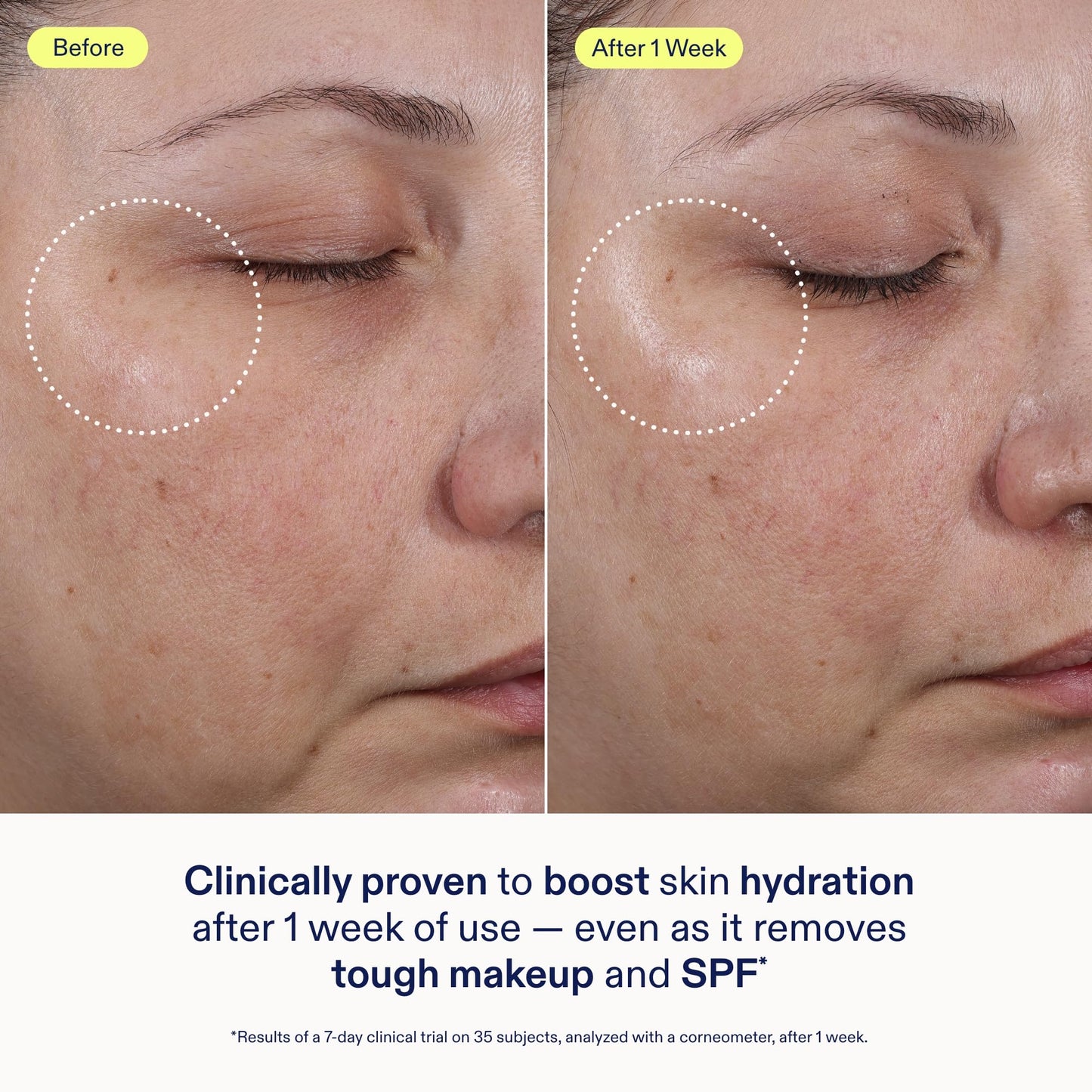 Skinfix Ceramide + Ectoin Gentle Gel Cleanser - 5 oz - SPF + Makeup Remover - Hydrates Skin - Vegan, Cruelty Free
