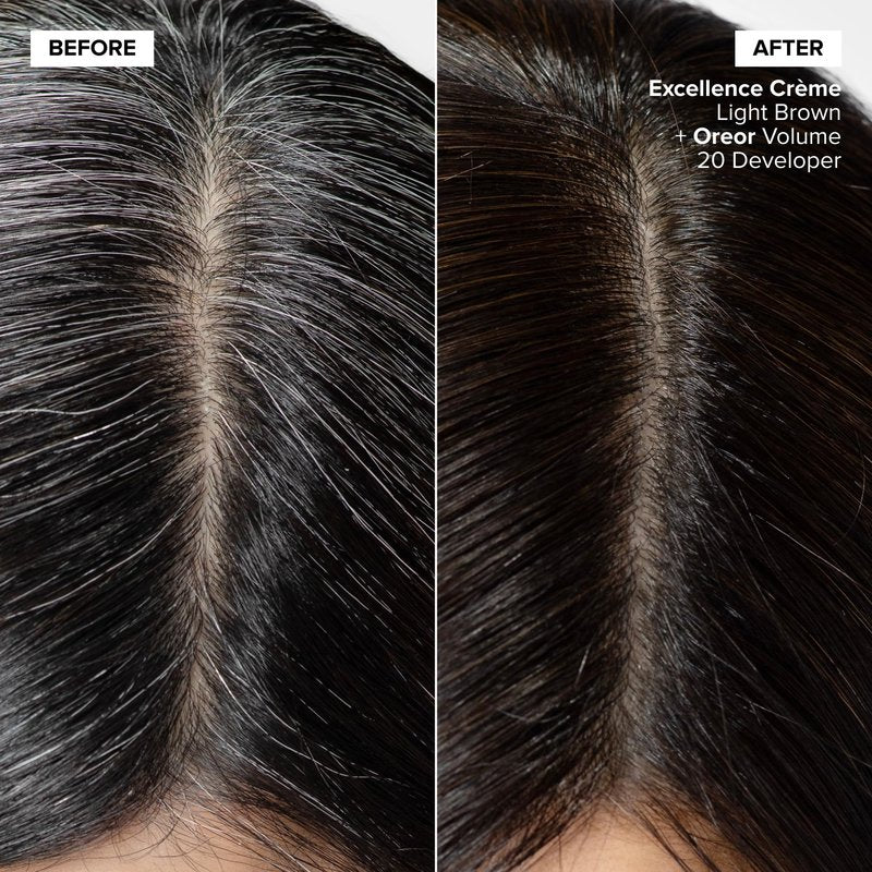 L'Oréal Technique Excellence Crème Permanent Hair Color - Long-Lasting Hair Dye, Rich Formula With No-Drip Application, Superb Gray Coverage, Medium Brown