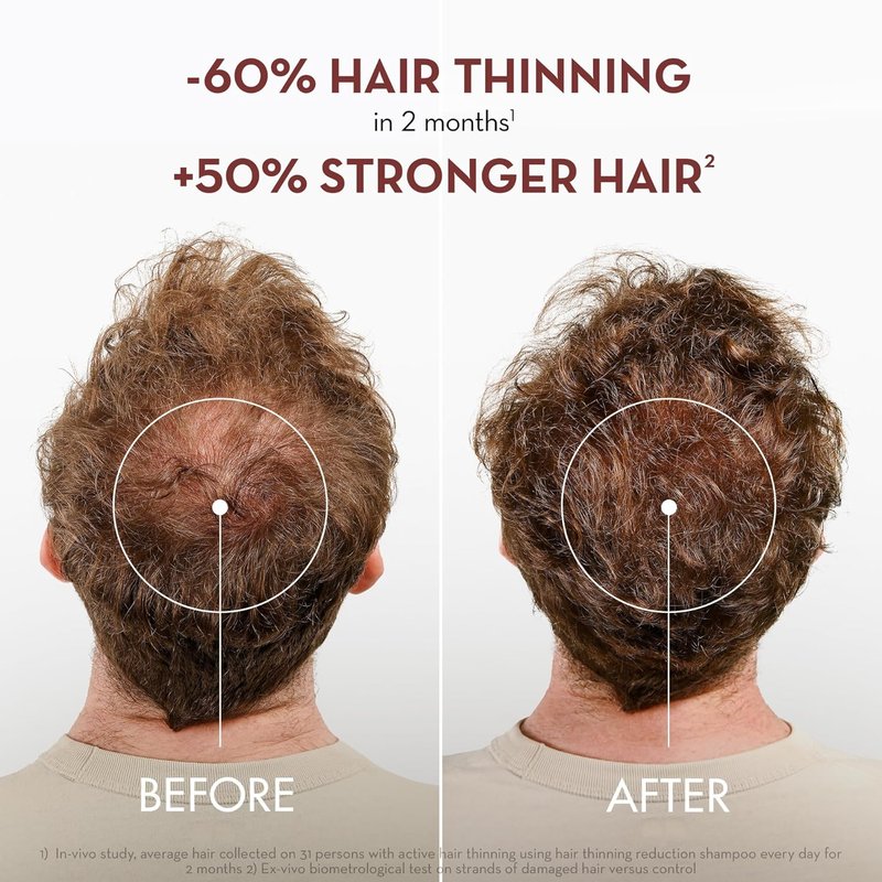 Klorane Strengthening Shampoo with Quinine - Natural Thickening Formula for Thinning Hair | 13.5 fl. oz.
