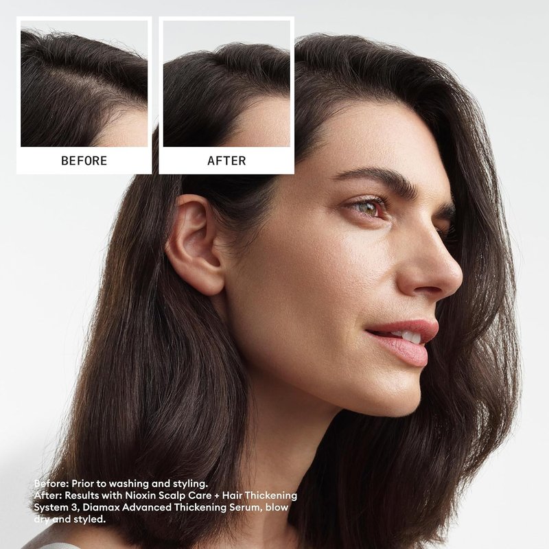 Nioxin System 3 Hair Thickening Shampoo - Nourish Colored & Damaged Hair | Strengthen with Niacinamide & Biotin | 10.1 Fl Oz