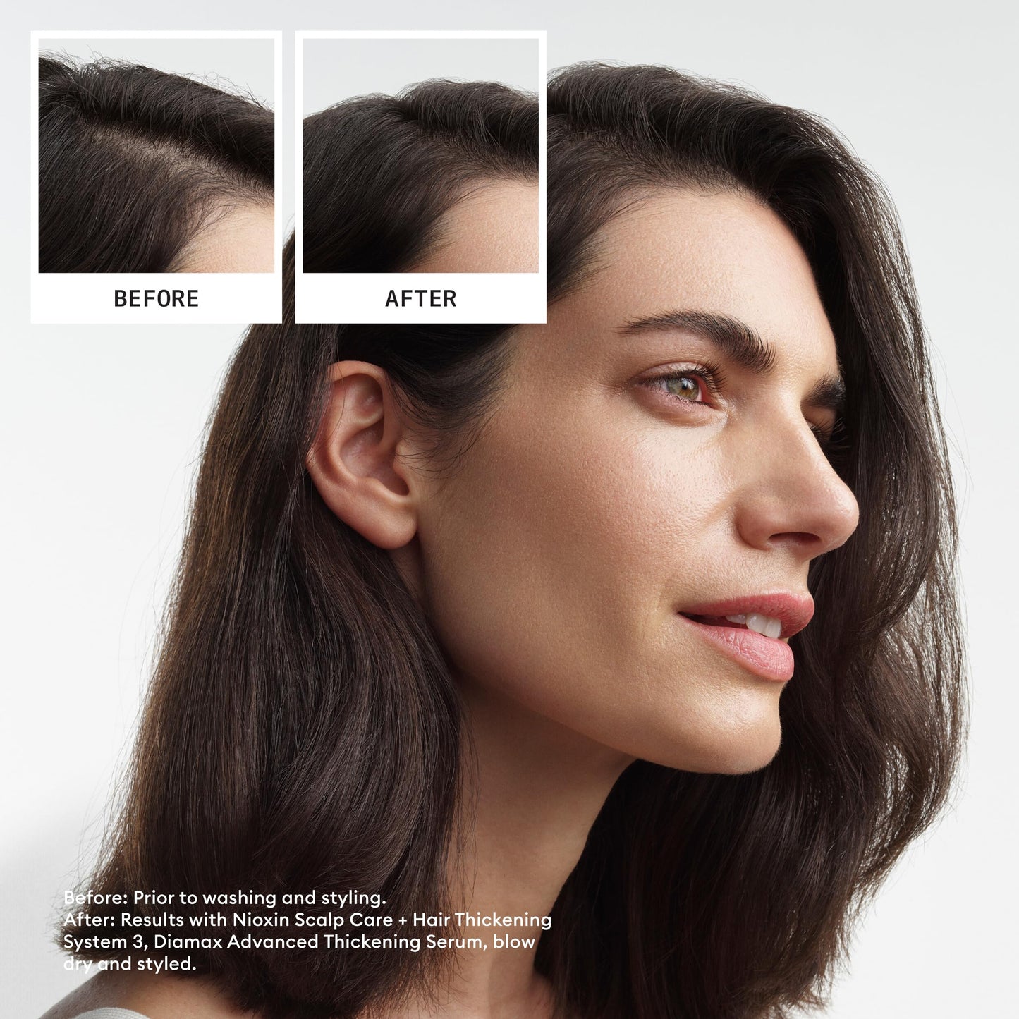 Nioxin System Kit 3, Color Treated Hair with Light Thinning, Full Size (3 Month Supply)