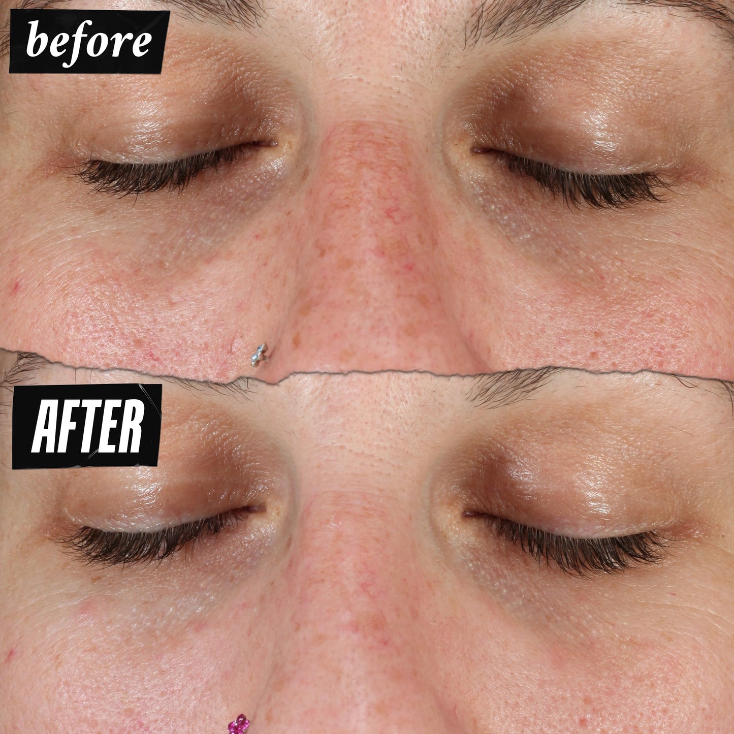 Kiehl's Clearly Corrective Dark Spot Serum, Corrective Skincare Solution Clinically Proven to Even Skin Tone, Plump Skin, Reduce Hyperpigmentation & Boost Radiance, Use as Spot Treatment or Serum