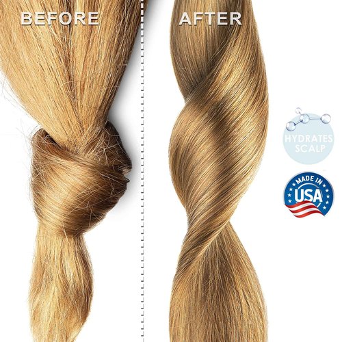 Soapeauty MEADOWFOAM SEED OIL Cold Pressed Unrefined | 100% Pure Natural Meadowfoam Seed Oil for Face & Hair | Moisturizer for Skin, Promotes Hair Growth, Balms | 8 fl oz