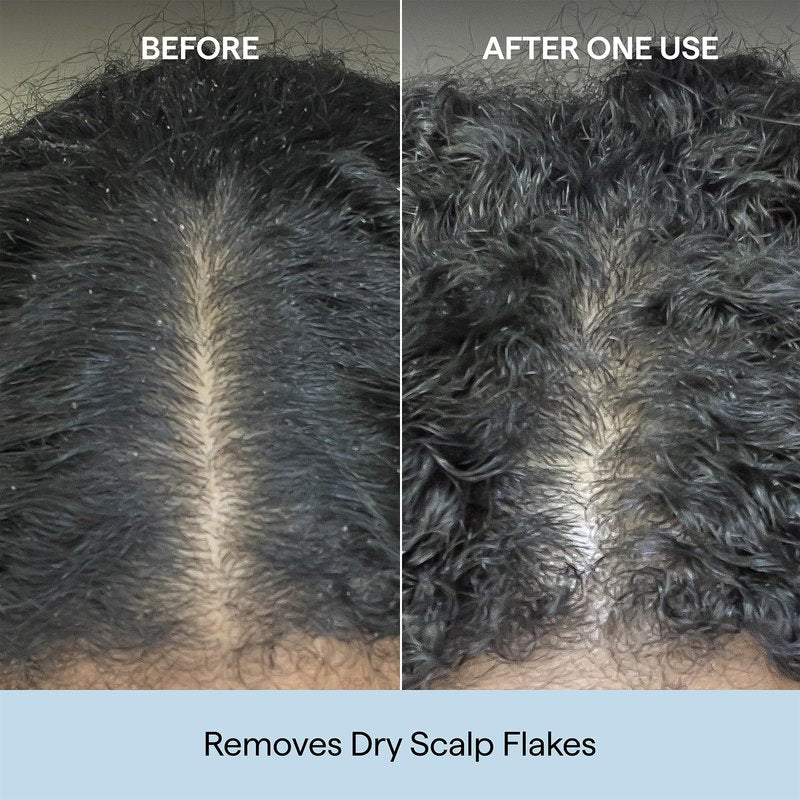 Briogeo Scalp Revival Charcoal + Coconut Oil Micro-Exfoliating Shampoo | Sulfate-Free Scalp Scrub for Dry, Itchy, or Oily Scalp | Detoxifying & Hydrating | Vegan & Cruelty Free | 32 oz