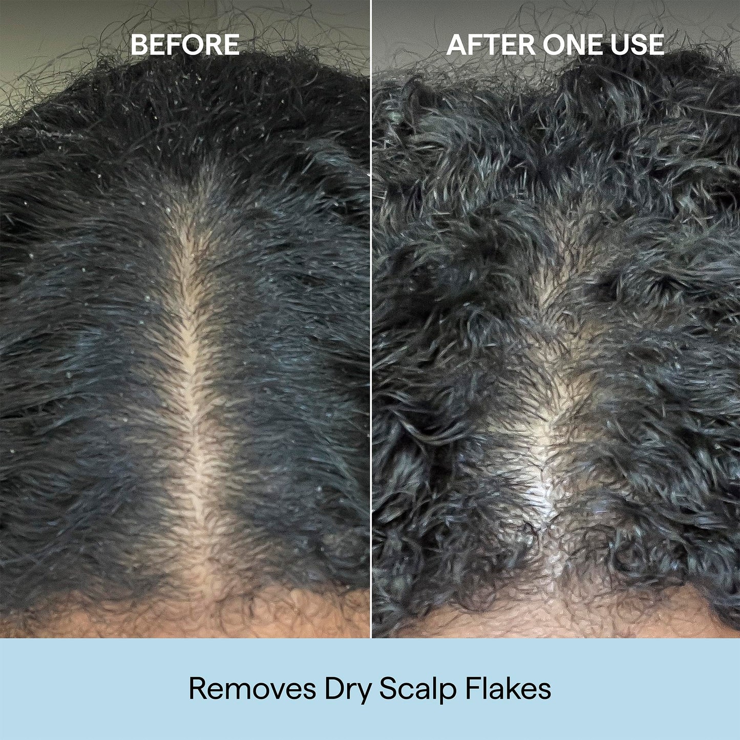 Briogeo Scalp Revival Charcoal + Coconut Oil Micro-Exfoliating Shampoo | Sulfate-Free Scalp Scrub for Dry, Itchy, or Oily Scalp | Detoxifying & Hydrating | Vegan & Cruelty Free | 2 oz