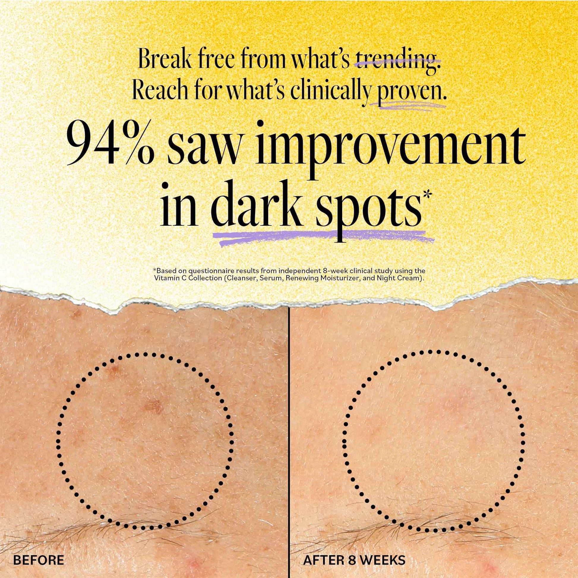 DERMA-E Vitamin C Intense Night Cream – Brightening and Hydrating Facial Skin Renewing Cream – Anti-Aging Overnight Facial Moisturizer, 2 oz