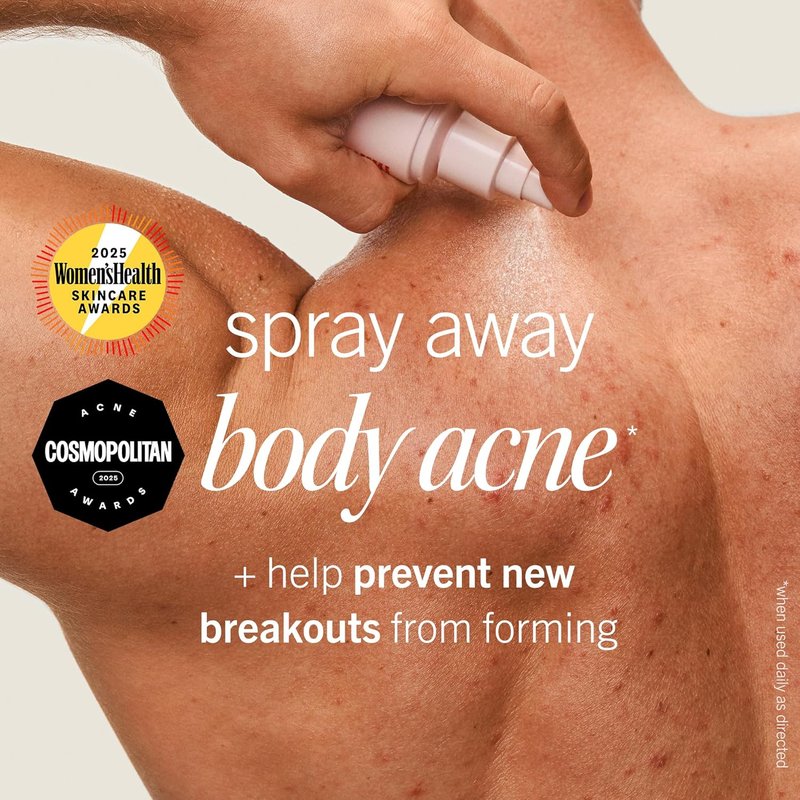 Body Acne Spray - Fast-Acting Treatment for Clear Skin | 6 oz