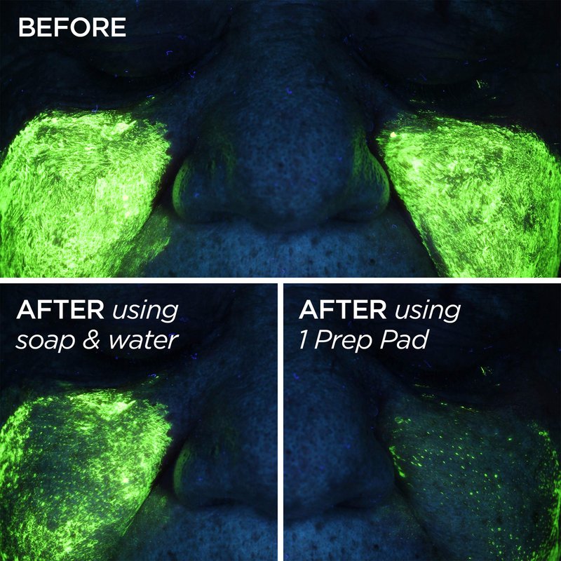 BeautyBio GloPRO Skin Prep Pads, Residue Erasing & Makeup Dissovling Daily Clarifying Pads