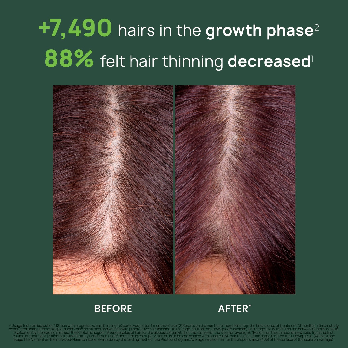 Rene Furterer TRIPHASIC Progressive Concentrated Serum, Thinning Hair Suitable for those Experiencing Hereditary & Hormonal Thinning, Drug Free Hair Thickening Serum, Energize Scalp, Hair Health