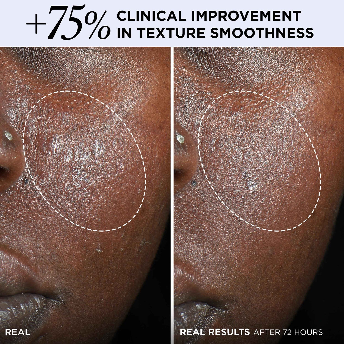 IT Cosmetics Confidence in a Cream Barrier Boost - Skin Barrier Repair Daily Face Moisturizer - Clinically Smoother, Softer Skin After 1 Use - Fragrance-Free, 100HR Hydration with Ceramide - 0.5 Fl Oz