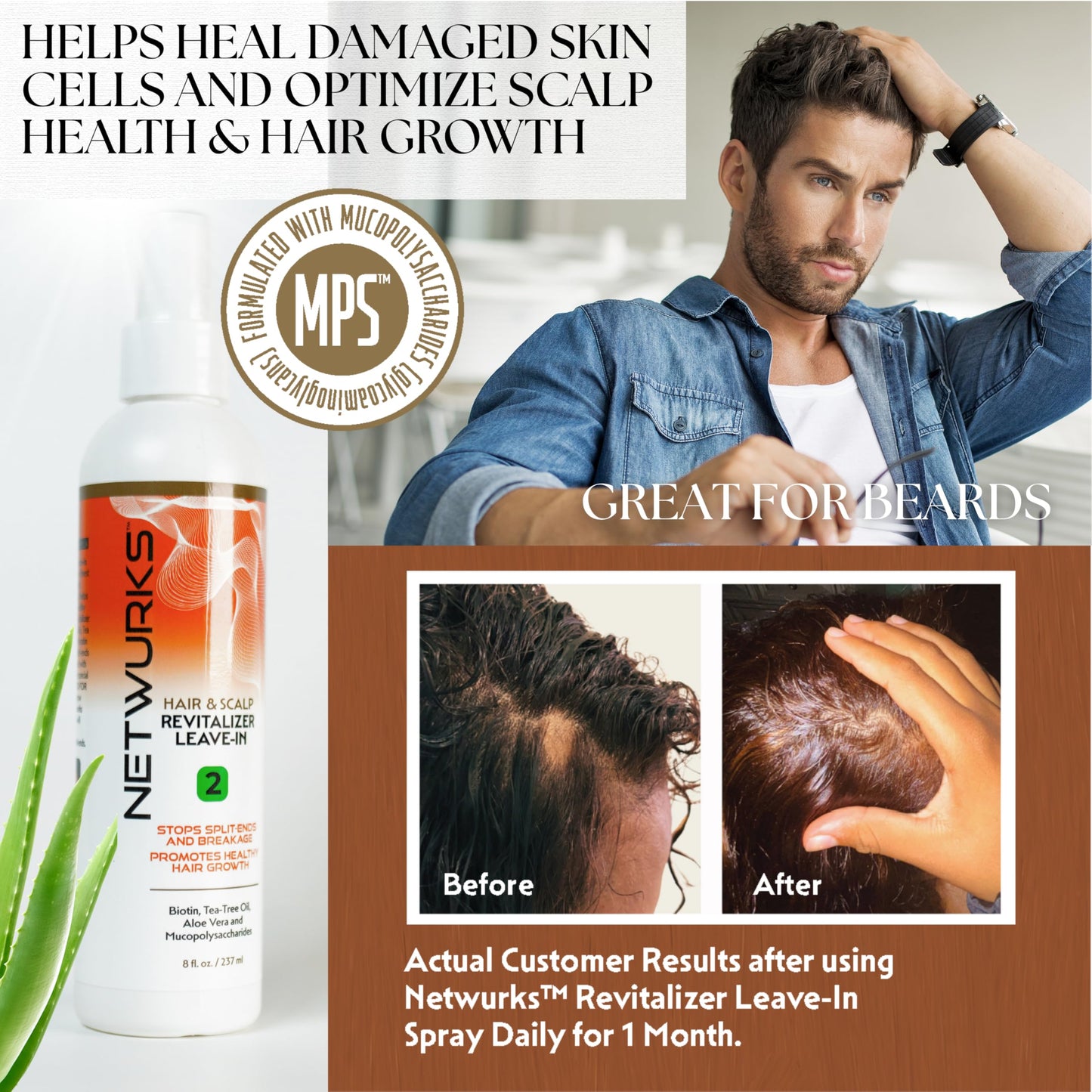 NetWurks Hair & Scalp Revitalizer Leave-In Spray | Restores Damaged Hair & Scalp | Heat Protectant | 8 Oz