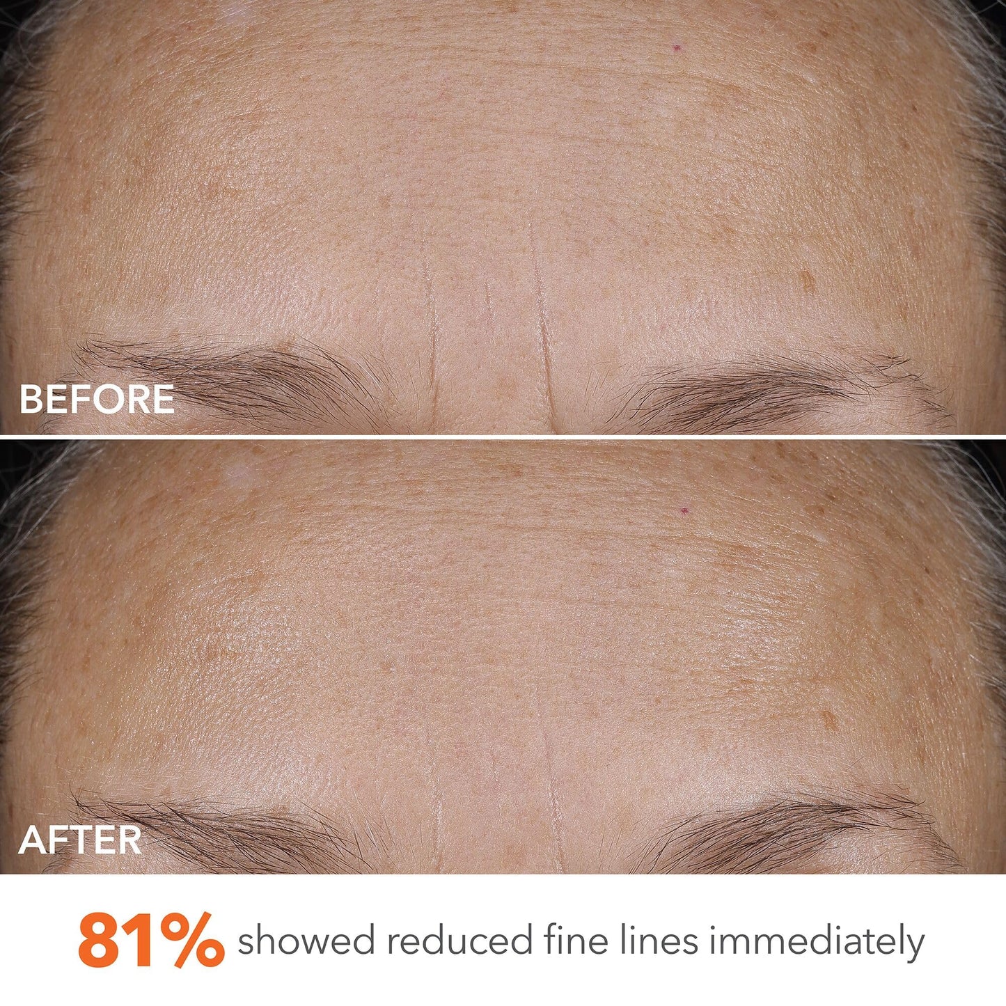 Dr Dennis Gross DermInfusions Blur + Repair Cream, Instantly Blurs Fine Lines, Smooths Skin with Satin-Matte Finish, Visibly Plumps & Firms & Improves Skin Elasticity, 0.67 Fl Oz