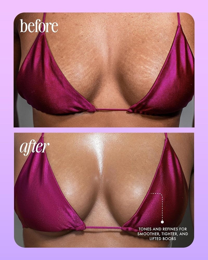 Acai Breast Firming Treatment - Smooth Textured Skin with Retinol & Antioxidants | 4 oz